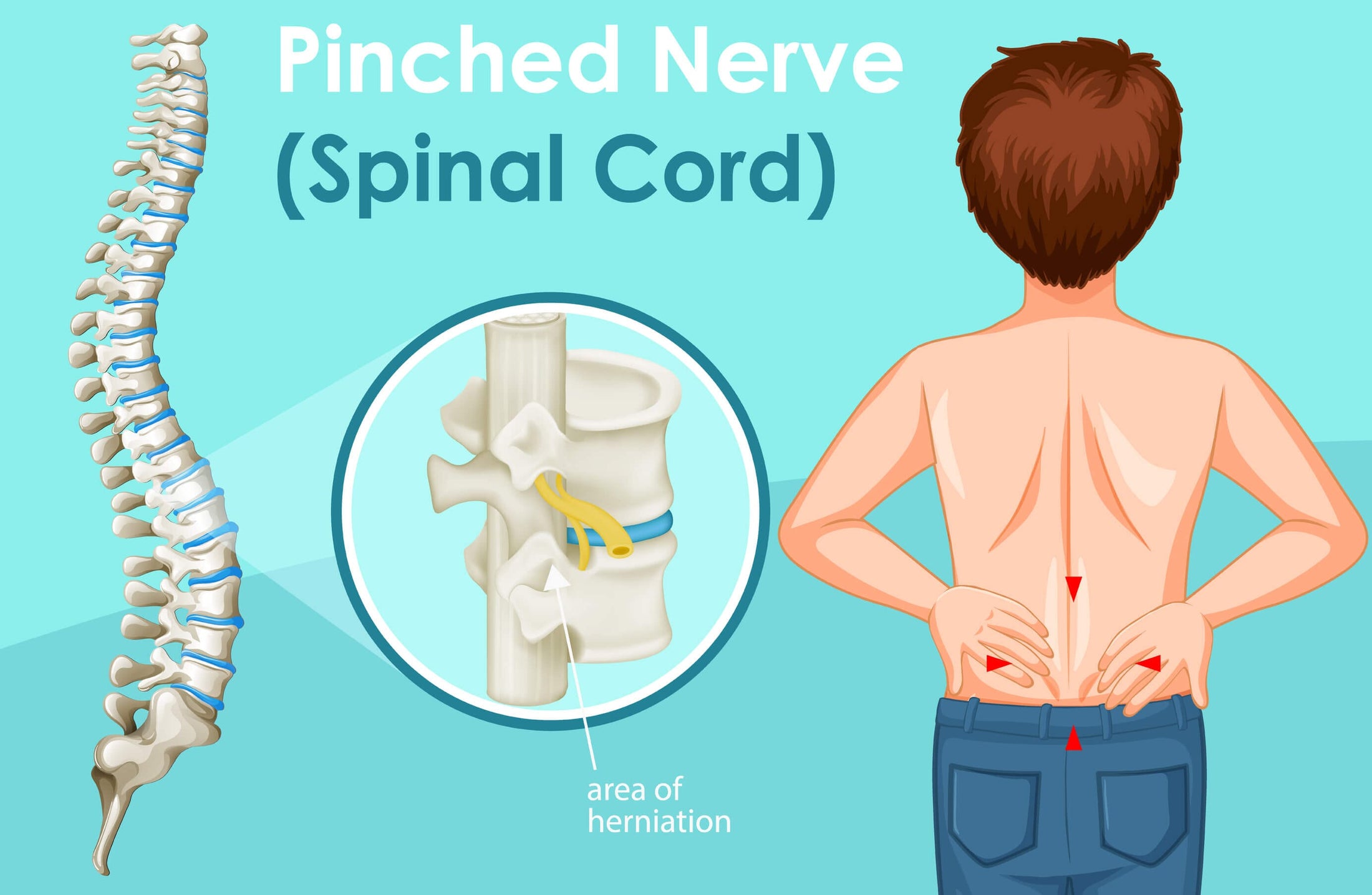 8-common-symptoms-of-a-pinched-nerve-and-how-it-feels-easy-posture