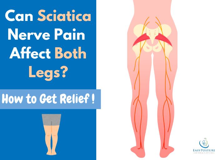 Can Sciatica Nerve Affect Both Legs? Get Fast Relief Now